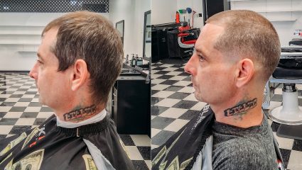 3-Before-and-after